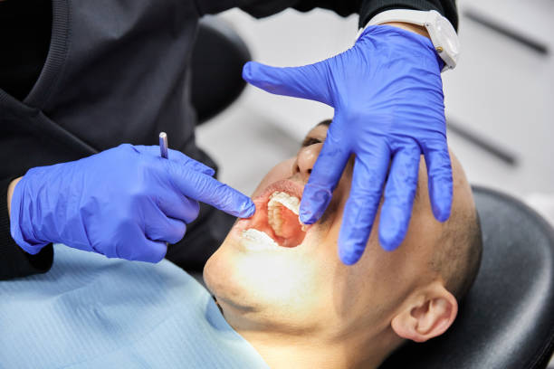 Best Emergency Tooth Extraction in Redland, MD